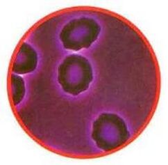 Stress of red blood cells