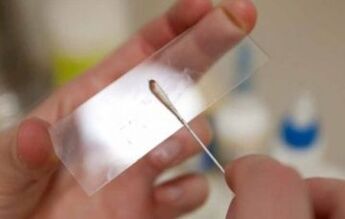 Which tests are to be performed for parasites