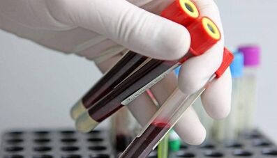 how to take tests for parasites in the body
