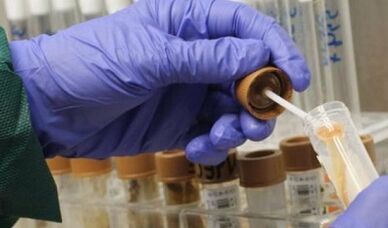 the need to pass on the analysis of parasites