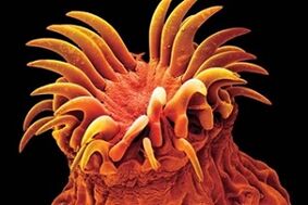 Trematode parasites of humans